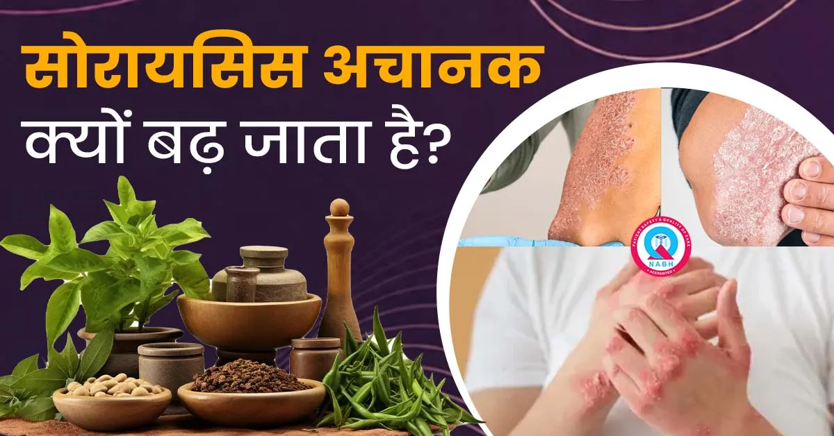 सोरायसिस-अचानक-क्यों-बढ़-जाता-है